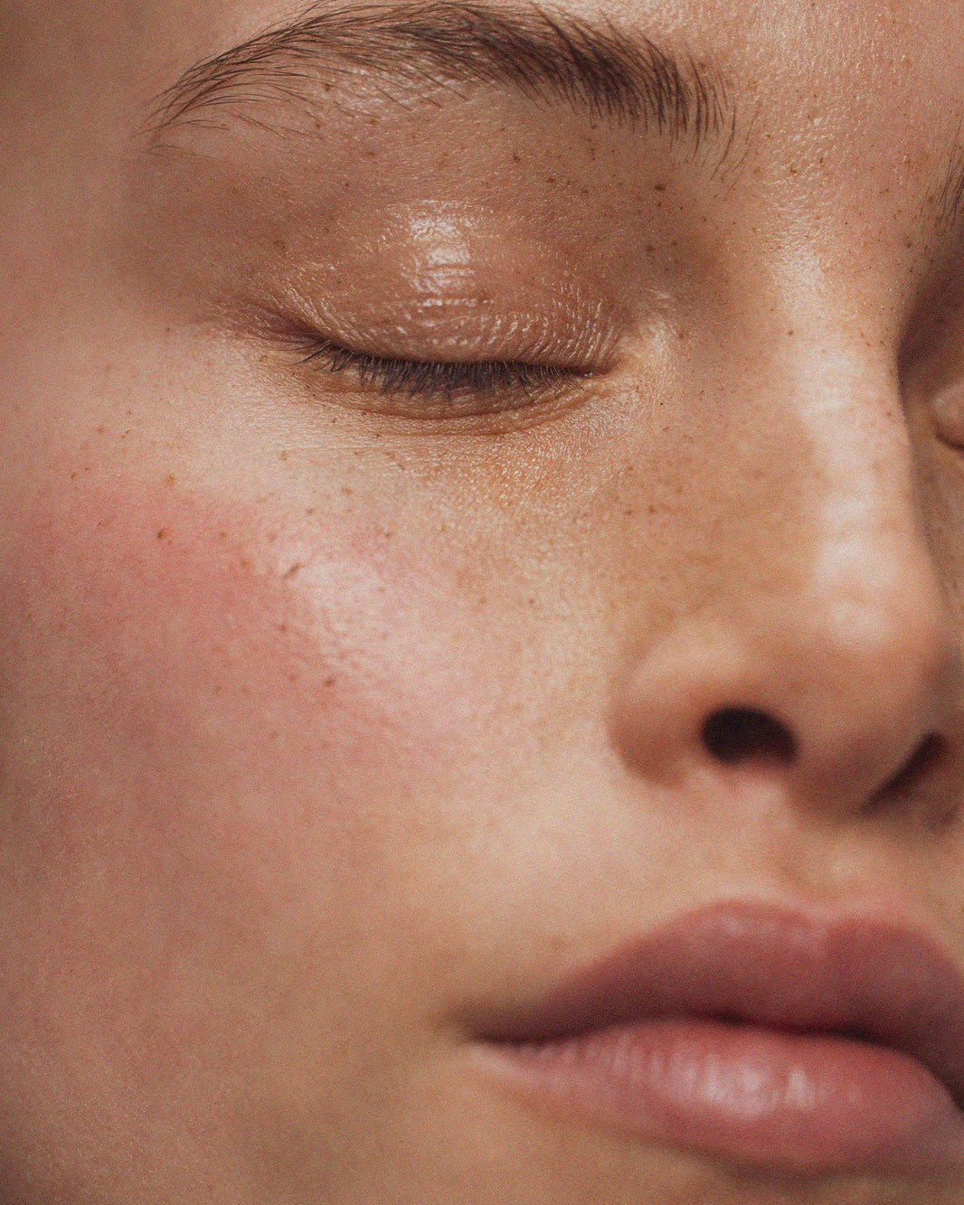 3 common myths about dry skin – debunked