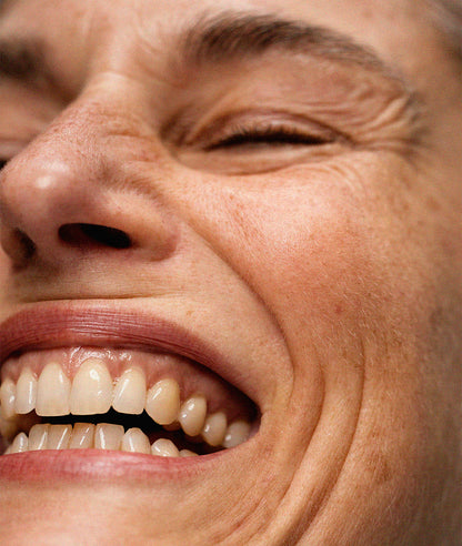 Vitamin A Treatment Cream